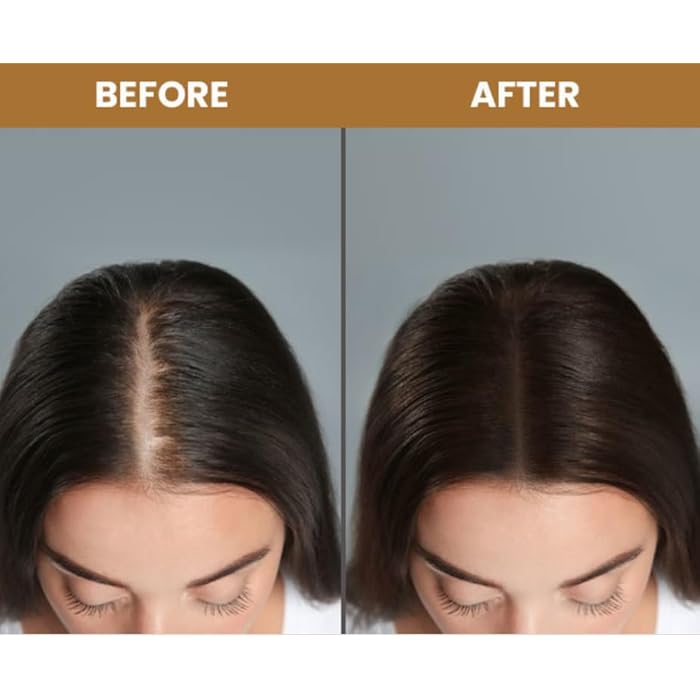 Infinity Top Hair Ampoules - Spanish Procapil Technology - Stimulates Hair Density & Strengthens Follicles - Best Treatment to Reduce Fall (8x10ml) I From Al Shabrawini Pharmacy - Image 3